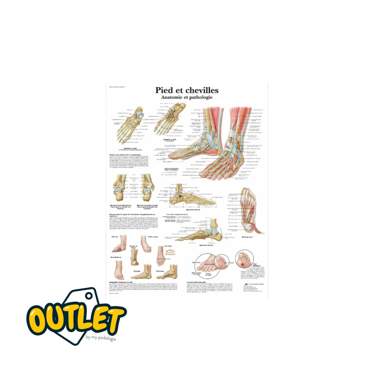 Planche anatomique - Pied et chevilles - Anatomie et pathologie // Défaut 3B Scientific 