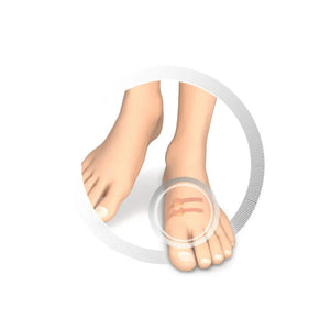 Protection pour orteils - Coussin creusé en latex souple - Protège contre la friction - 9 pièces - Ruck Ruck 